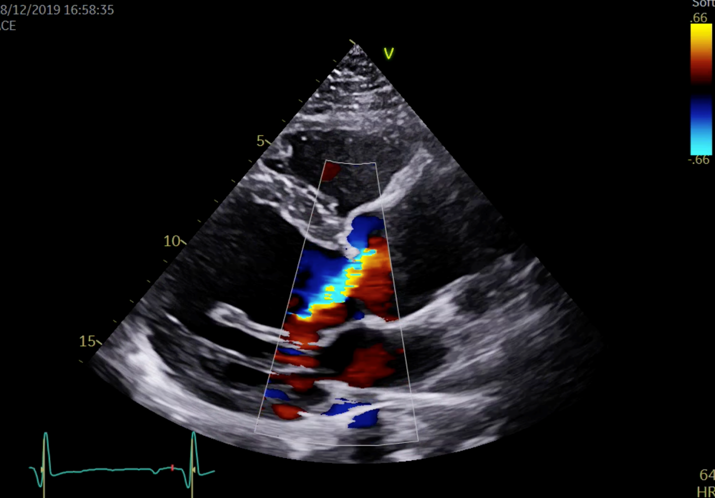 infos-patients-cardiologie-imm-institut-mutualiste-montsouris