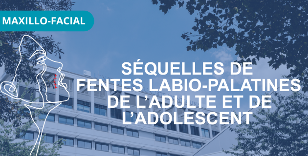 Séquelles de fentes labio-palatines de l’adulte et l’adolescent