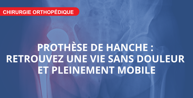 Prothèse de hanche à l'IMM (Paris 14) : retrouvez une vie sans douleur et pleinement mobile