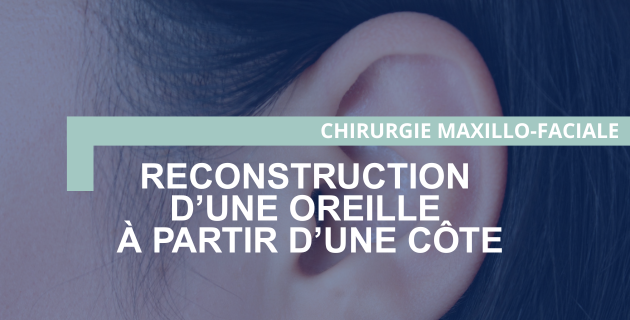 Chirurgie maxillo-faciale : reconstruction d’une oreille à partir de côtes (otopoïèse)
